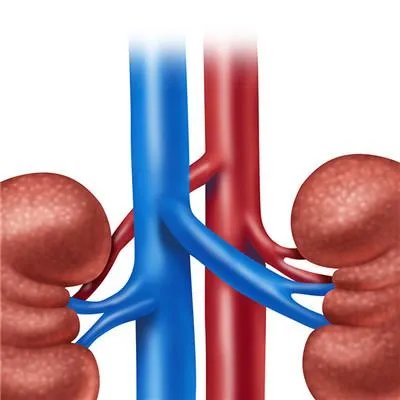 肾积水是什么原因?