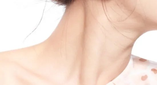 如何把脖子上的皱纹去