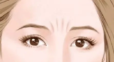 去眉间纹的好办法