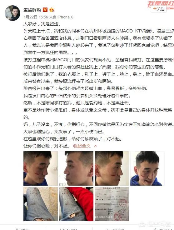 贝拉拉是谁，最近为什么这么火？听说他在工体被打了？