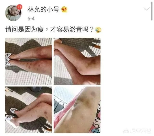 刘德华拍戏时坠马受伤,演员拍戏时到底有多拼?