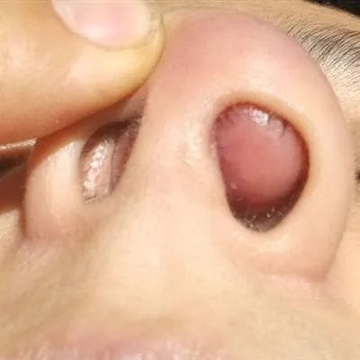 做鼻部整形去哪里好?