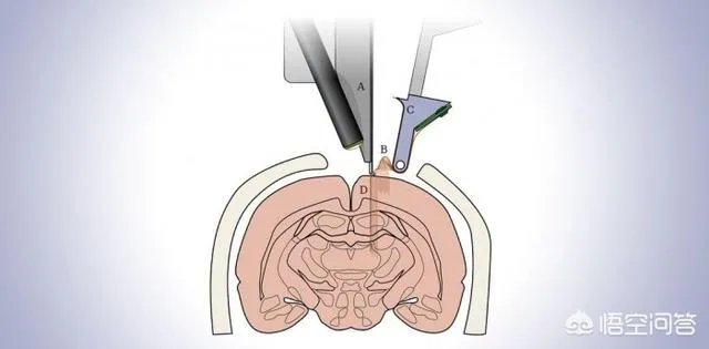 马斯克的Neuralink是怎样一家公司？