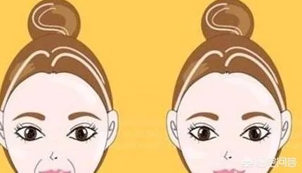 面部提升埋线是怎么回事？