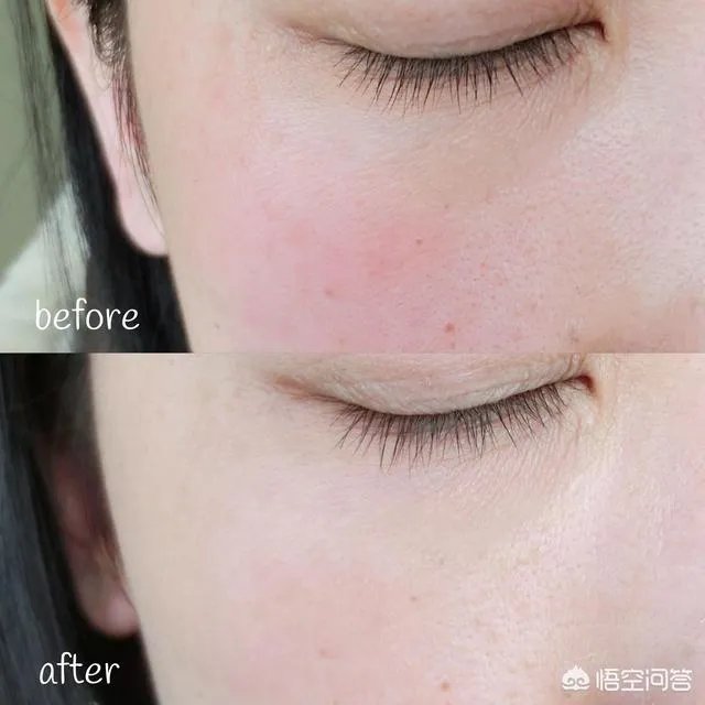 美白面霜排行榜有哪些？