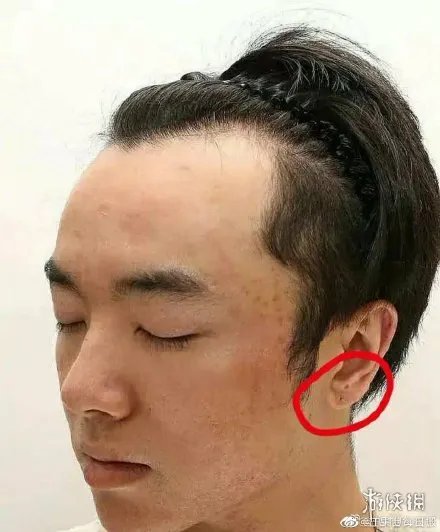 发发爱我2021华晨宇是什么梗 发发爱我2021爆料华晨宇整容