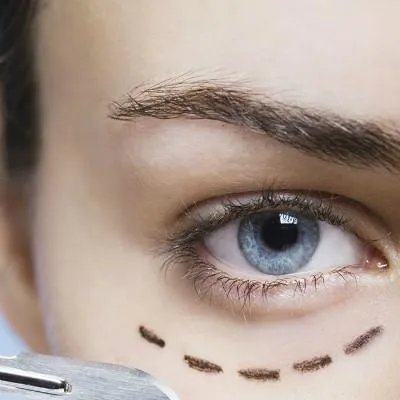 注射玻尿酸费用多少