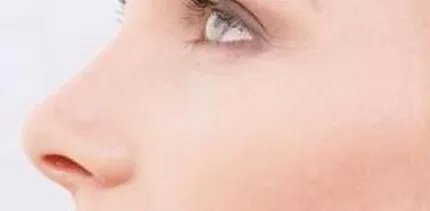 隆鼻修复手术安全吗