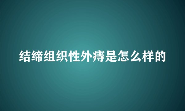 结缔组织性外痔是怎么样的