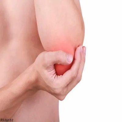 肘关节脱位做什么检查