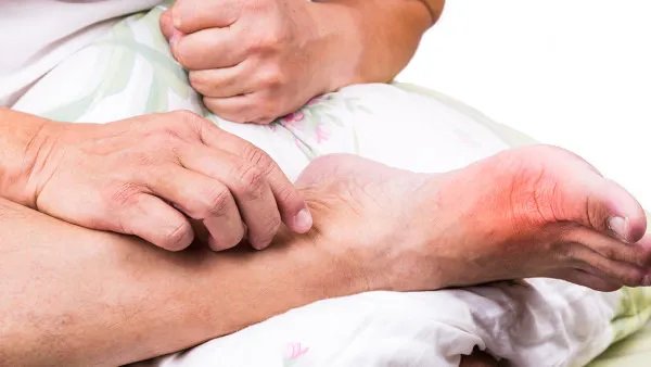 脚浮肿是怎么回事