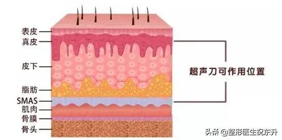 超声刀危害有哪些？