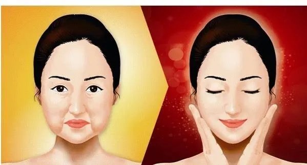 面部提升埋线是怎么回事？