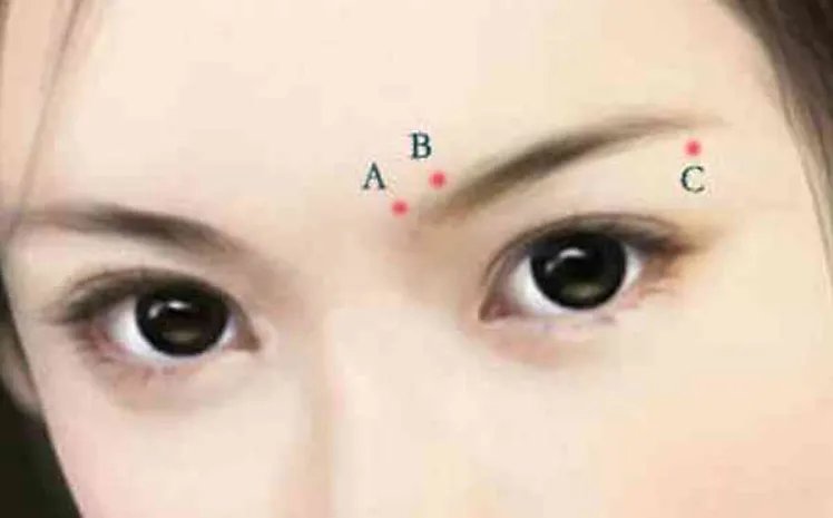 广州双眼皮整形哪个医院好