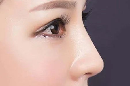 玻尿酸隆鼻一般多少费用