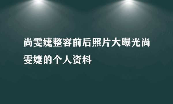 尚雯婕整容前后照片大曝光尚雯婕的个人资料