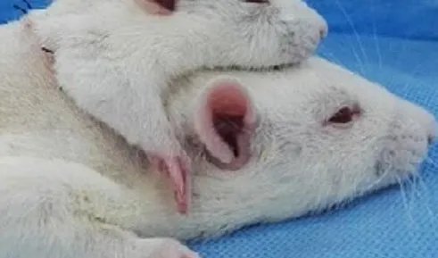 世界首例头颅移植手术实验成功是真的吗？