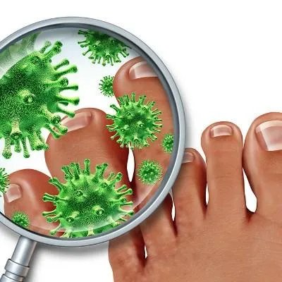 什么是扁平足判断