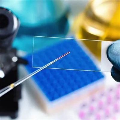 胆固醇高什么症状