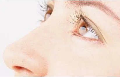 假体隆鼻后的注意事项是什么