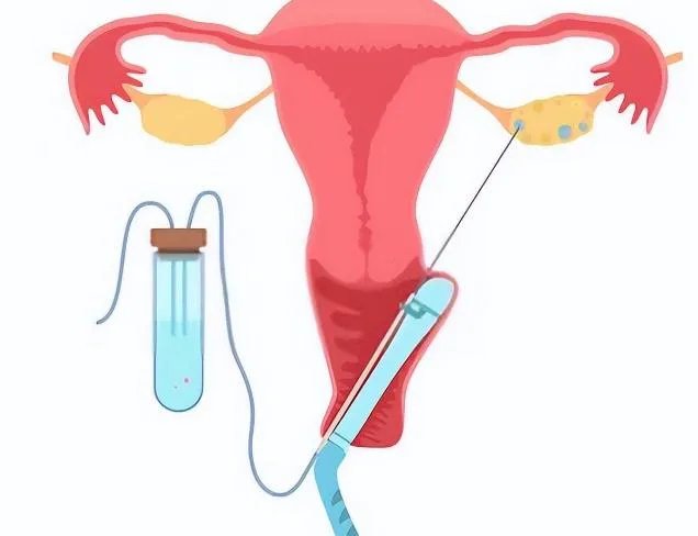 通州市供卵-常州市妇幼捐卵人,常州市捐卵公司