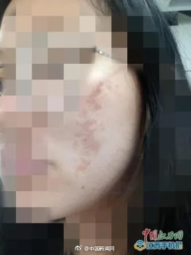 网曝南昌天虹使用伪劣化妆品致多名大学生毁容，是怎么一回事？