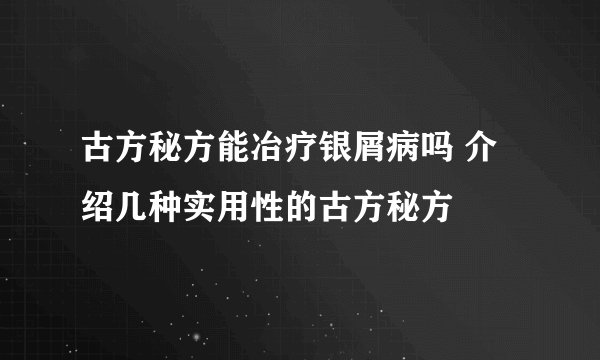 古方秘方能冶疗银屑病吗 介绍几种实用性的古方秘方