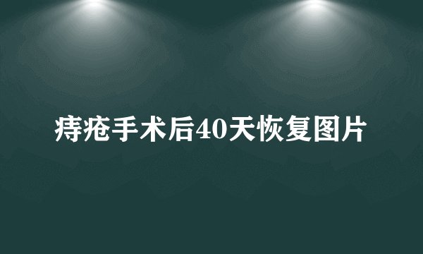 痔疮手术后40天恢复图片