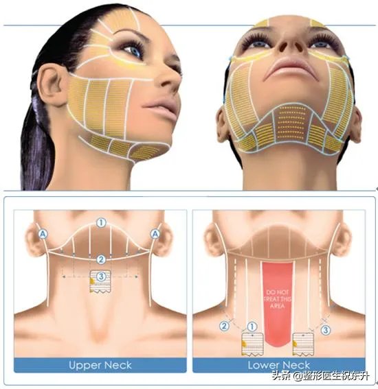 超声刀危害有哪些？