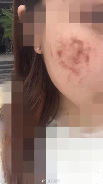 网曝南昌天虹使用伪劣化妆品致多名大学生毁容，是怎么一回事？