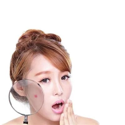 哪个治青春痘医院比较好??