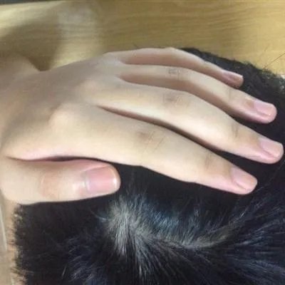 治疗白发的最好办法