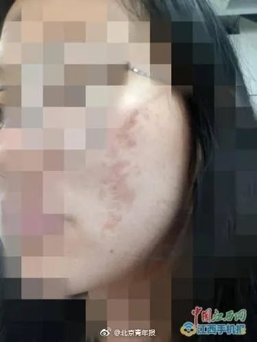 网曝南昌天虹使用伪劣化妆品致多名大学生毁容，是怎么一回事？