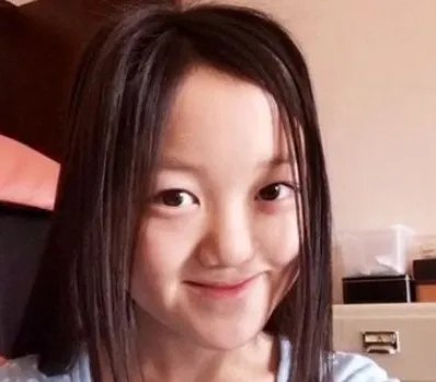 王菲女儿治疗兔唇花了几百万,嘴是治好了,但脸为何却越来越奇怪?