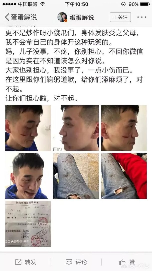 贝拉拉是谁，最近为什么这么火？听说他在工体被打了？