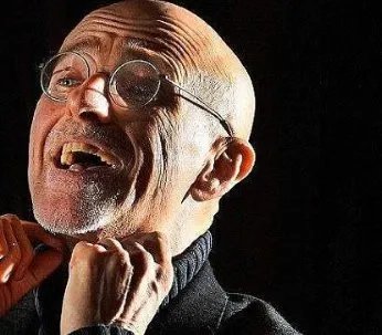 世界首例头颅移植手术实验成功是真的吗？