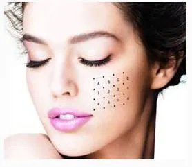 面部提升埋线是怎么回事？