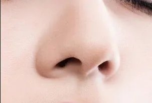 北京隆鼻整形哪家医院做的效果好 | 费用表分享_女孩子整容对生育有没有影响