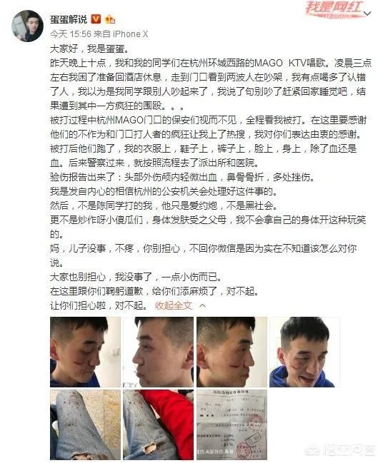 贝拉拉是谁，最近为什么这么火？听说他在工体被打了？