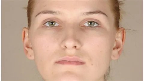 去法令纹用什么好