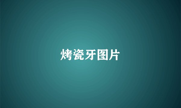 烤瓷牙图片