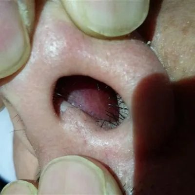 做鼻部整形去哪里好?