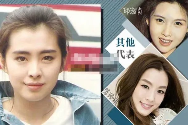 美人尖是什么?发际线中的一个尖(出现概率仅千分之一)